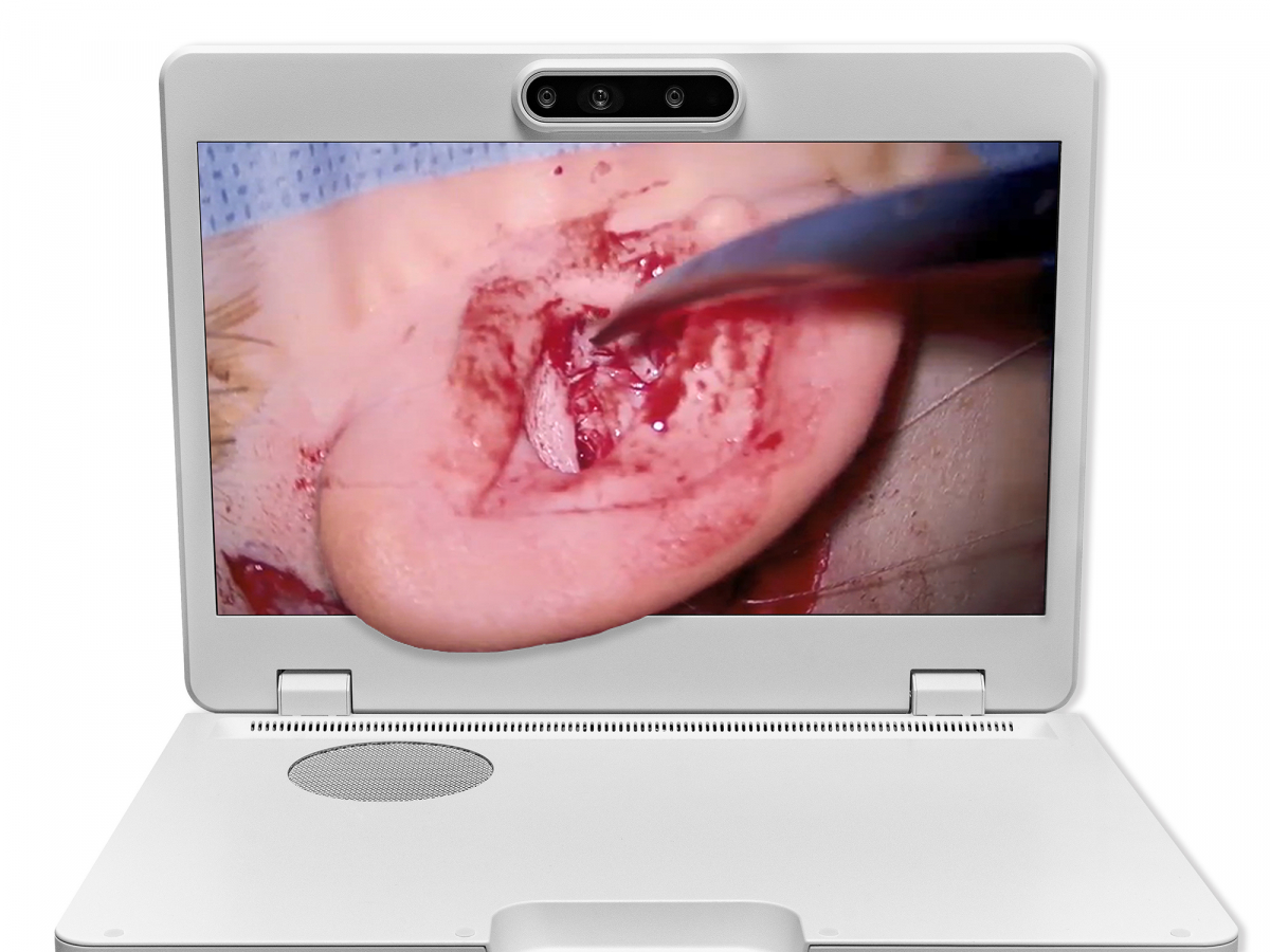 达擎之＂Heads-up 3D显微手术显示系统＂，整合4K裸眼3D显示及眼球追踪系统，具备快速追踪人眼移动位置功能，减轻医师长时间维持固定姿势的负担，让医师能有更宽广清晰的3D立体视野及更舒适的姿势来执行手术。